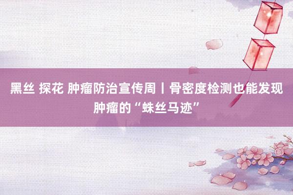 黑丝 探花 肿瘤防治宣传周丨骨密度检测也能发现肿瘤的“蛛丝马迹”
